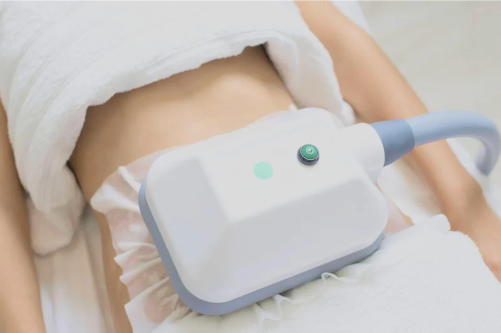 How Fat Freezing and HIFU Work Together? 3 advantages to combining Fat Freezing and HIFU West Tilbury