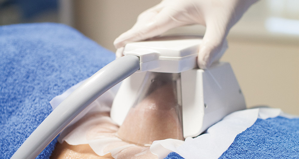 How Fat Freezing and HIFU Work Together? 2 Multiple Areas in One Session HIFU and Fat Freezing West Tilbury