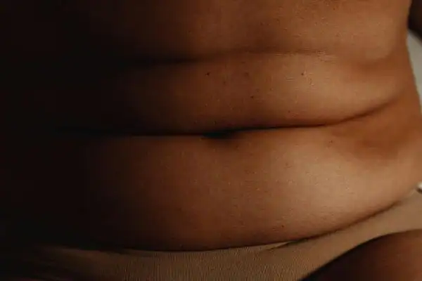 The Hidden Connection: How Stress Shapes Your Fitness and Body Composition 3 image of what stress can do on the stomach area and how Lipo 360 West Tilbury can help to change your body shape.